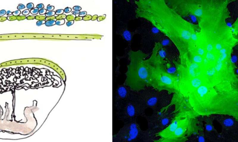 高危妊娠：干扰素的影响