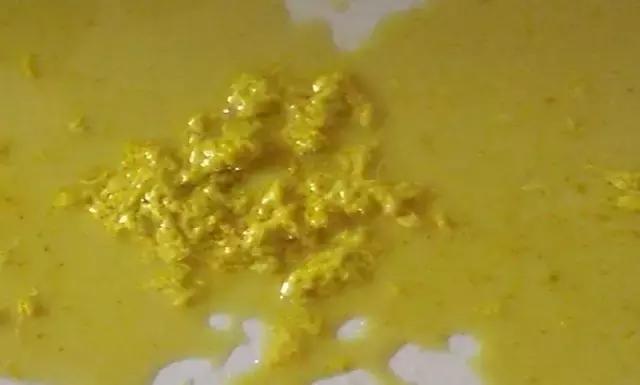 奶瓣、绿便、腹泻、便秘...宝宝的各种便便真图全解！建议收藏