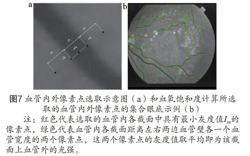 视网膜血氧饱和度测量仪,基于双目视觉的图像测量技术