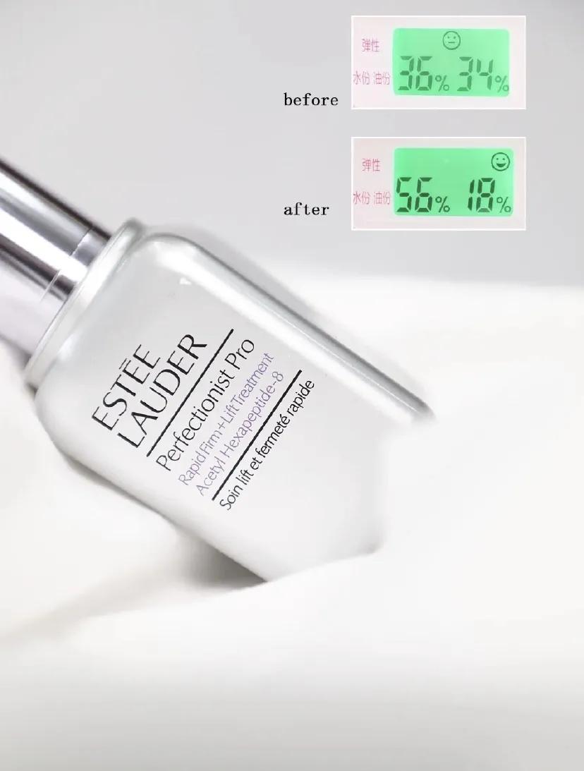 雅诗兰黛线雕精华去法令纹真假,法令纹抬头纹雅诗兰黛线雕