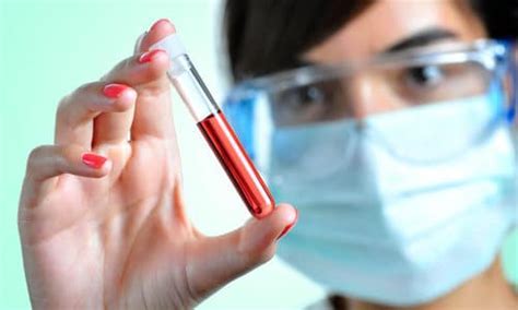 辟谣：痛风非布司他副作用大，尽量不服用。医生讲清楚用药细节