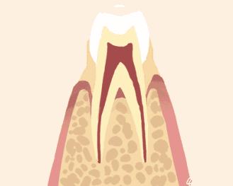 牙齿松动是身体有病吗,牙齿松动了如何正确的解决呢