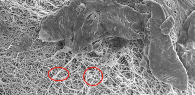 拯救毛孔粗大测评,毛孔粗大拯救全过程