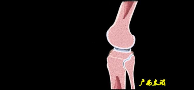 听骨科医生讲的话,听完骨科专家的一段话
