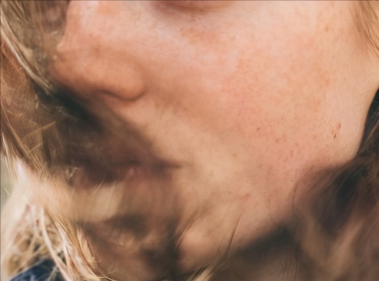 轻微的色斑和雀斑怎么去除,雀斑黄褐斑老年斑等各种问题