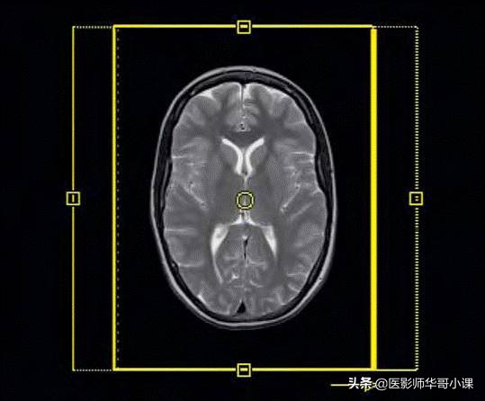 西门子mri界面讲解与操作,西门子mri序列名称