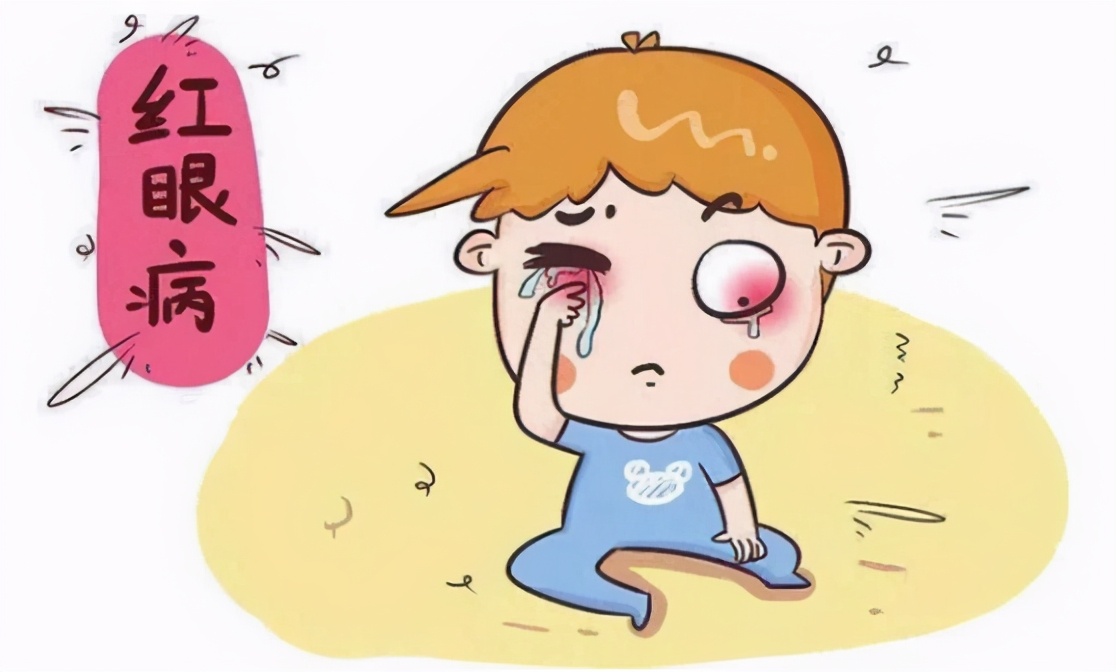 眼睛红了莫小视，因为结膜炎可能找上“门”
