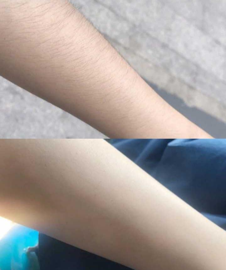 猕猴桃夏日脱毛,猕猴桃女孩轻松脱毛的救星