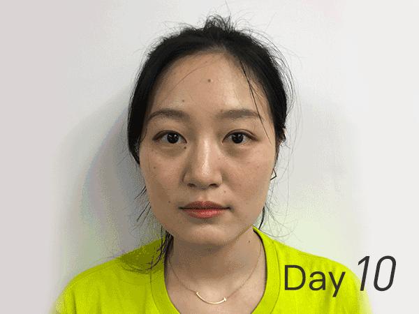 大牌美白精华液哪个好用又便宜,大牌祛斑精华液美白淡斑第一名