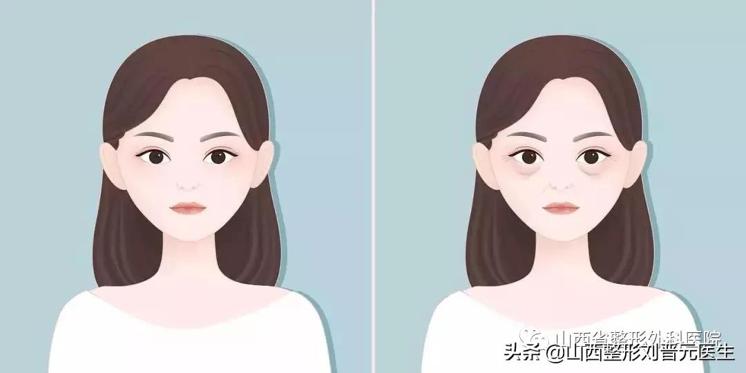 眼袋的*伤杀**力有多大？让小姐姐欲哭无泪