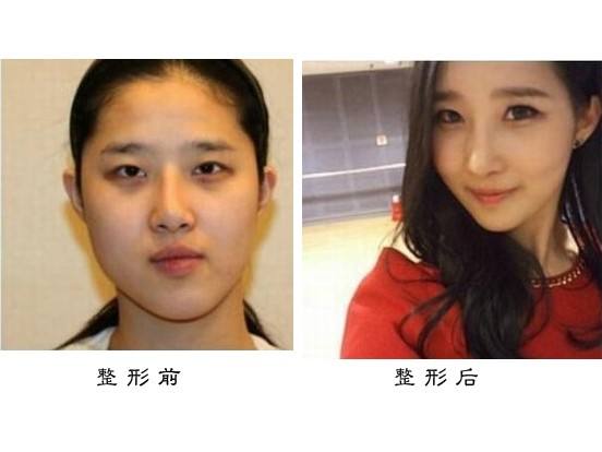 家用射频美容仪有用吗专家讲解,家用射频美容仪有效果吗