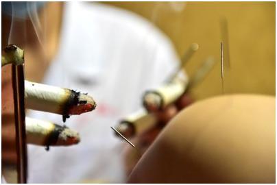 月子病艾灸哪些穴位排寒湿,寒湿对女人的危害