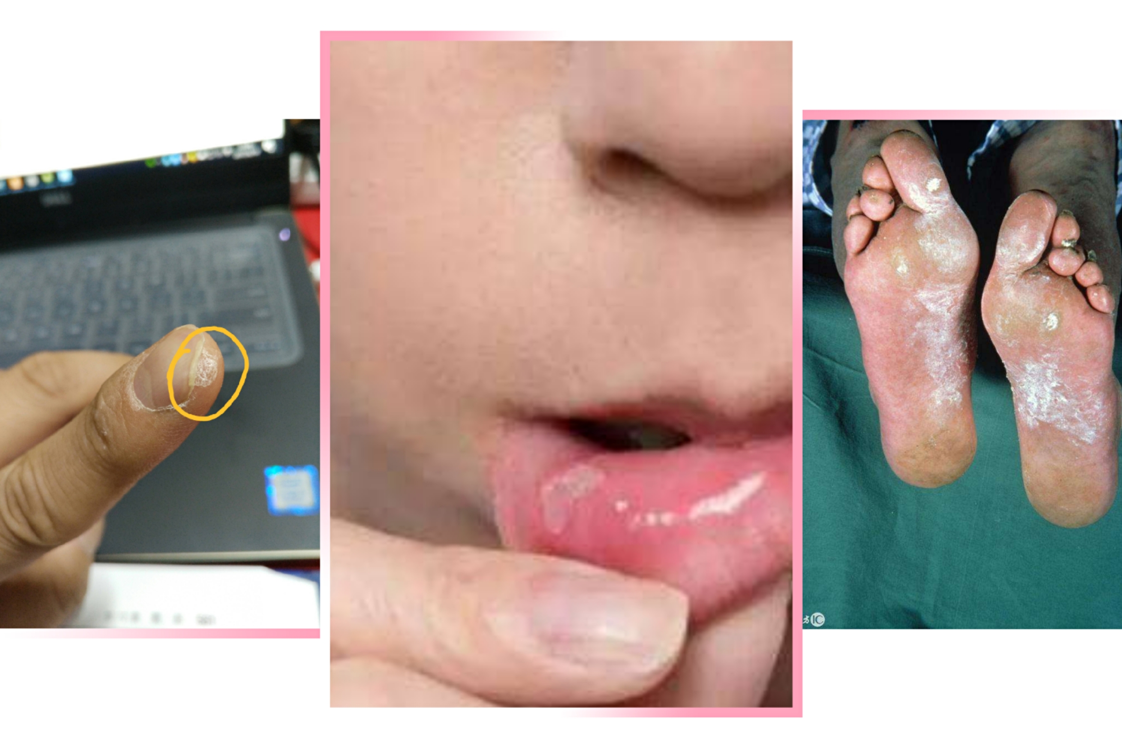 烟酰胺olay小白瓶美白效果,olay小白瓶烟酰胺提亮美白