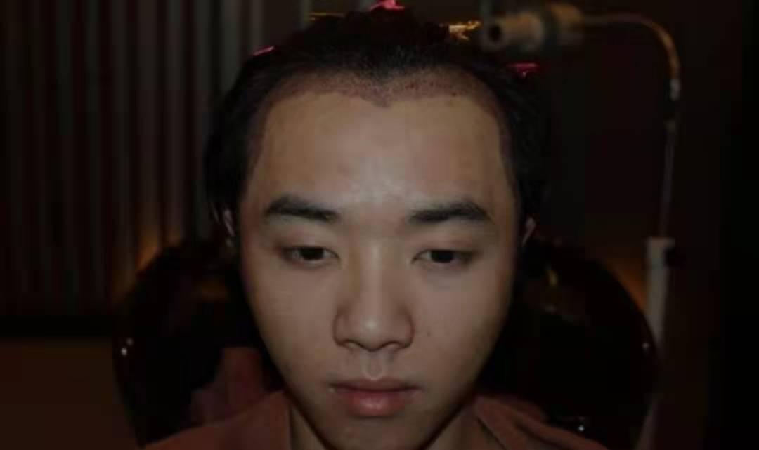 张碧晨说华晨宇真实人品,华晨宇张碧晨2017年绯闻照片