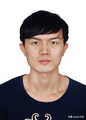 淋巴管瘤在68Ga-NOTA-EvansBluePET/MRI上的表现