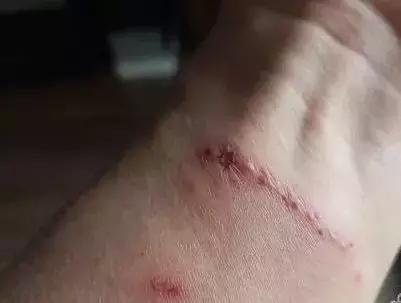 隐形虫出没地方,虫出没名场面