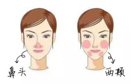 红血丝的原因你找到了吗,全面了解红血丝超全知识版