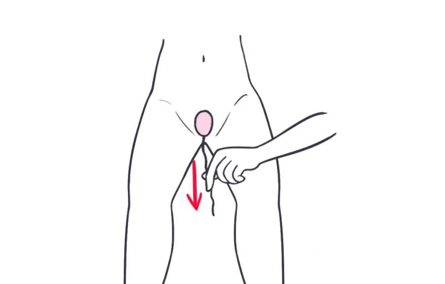 产后为什么哑铃总是掉出来,产后哑铃是要完全放进去么