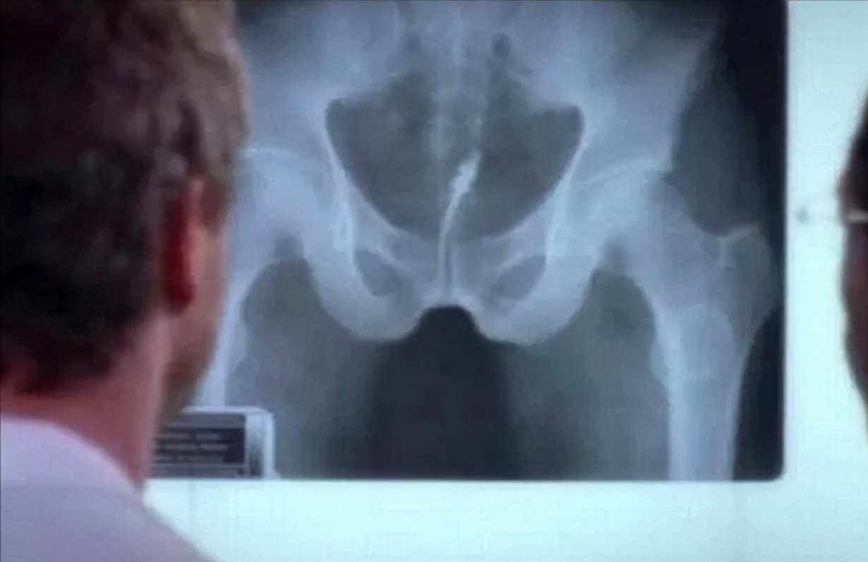 亚马逊吸血鬼鱼,亚马逊吸血鬼