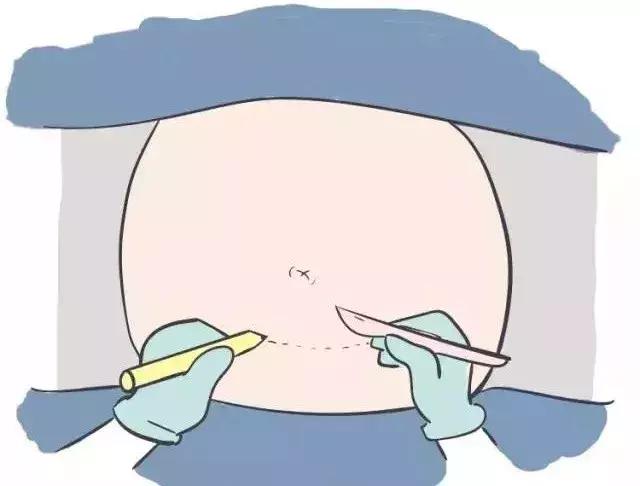 世上最丑的“微笑”……你不喜欢拥有它，但它的伟大无可否认！