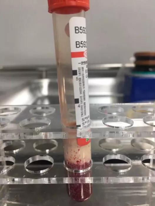 22岁女孩喝奶茶喝进icu,女孩4天喝饮料进了icu