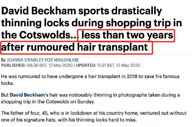 贝克汉姆为什么剃光头都那么帅,男神贝克汉姆