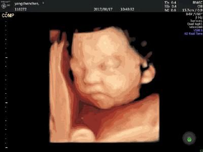 吃榴莲后胎儿胎动频繁好不好,孕妇吃榴莲胎动频繁正常吗