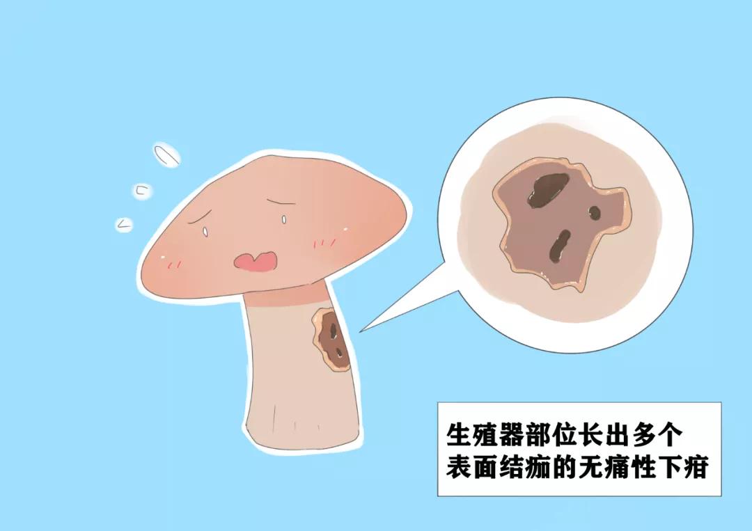 性病界的潜伏高手——梅毒