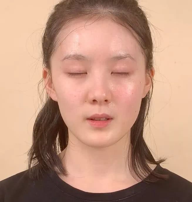 微整的真实效果,微整蜕变过程