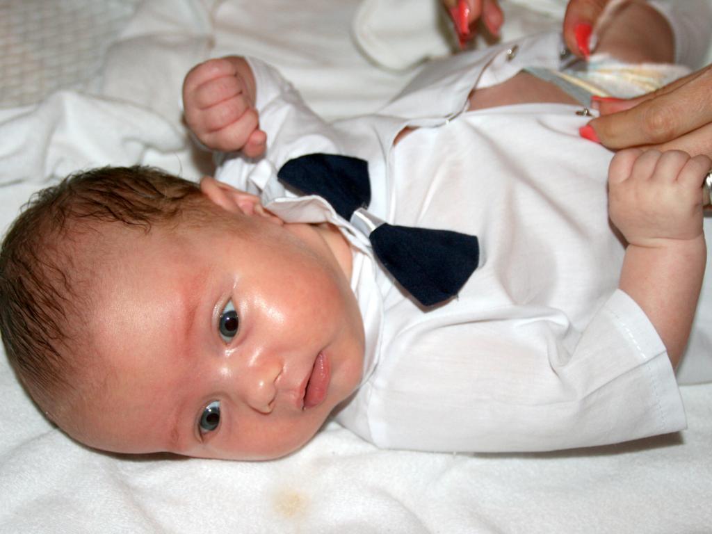 宝宝牙龈发炎脸肿了怎么消肿最快,宝宝牙龈肿了导致脸部肿有点红