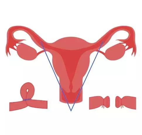 全球首款男性避孕药要来了,男用避孕药研发成功了吗