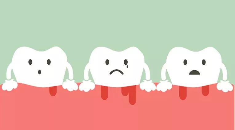 牙龈炎是上火吗喝什么药,由上火引起的牙龈炎应该吃什么药