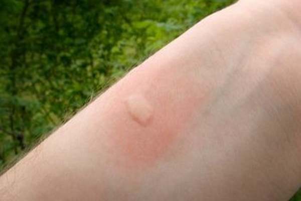 效果好又便宜常用药膏,几款管用的小药膏