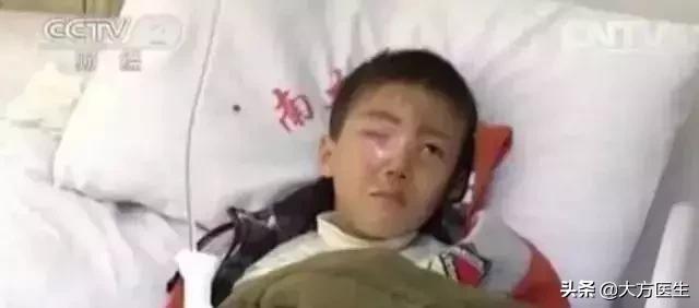男孩眼球被溶化是怎么回事,8岁小孩眼球融化
