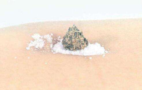 艾灸和针灸疏通经络哪个效果好,痛经是艾灸效果好还是针灸效果好