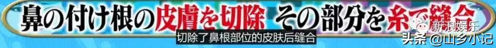 明明是整容脸现在却成了颜值巅峰,明明是整容脸却没被吐槽过