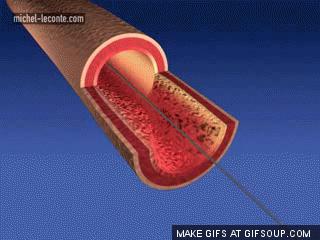 肿瘤介入术后饮食指导,肿瘤切除手术以后的饮食安排