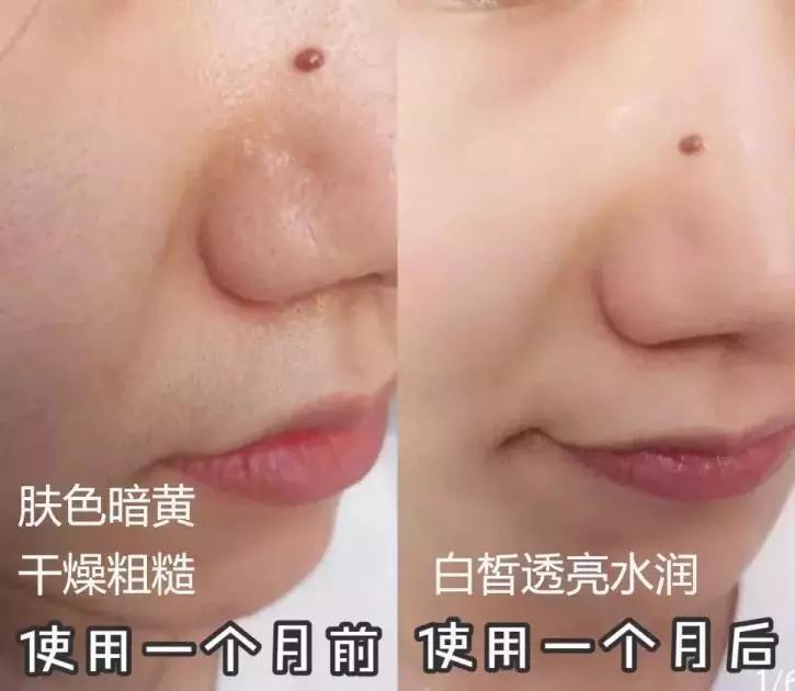 国外大牌虾青素精华,新西兰虾青素水光肌精华