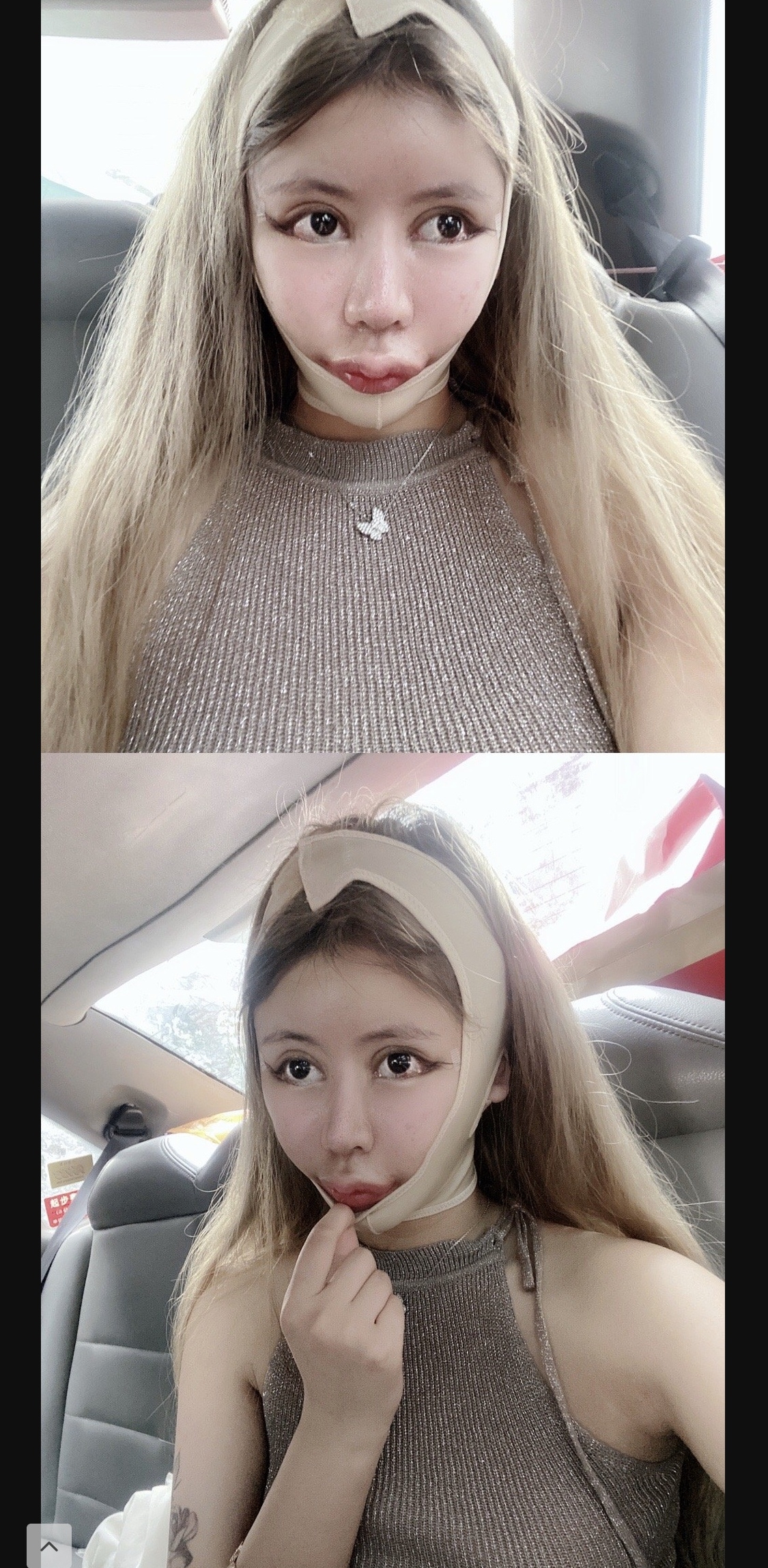 导演为什么不让演员整容,为什么导演不喜欢整容的演员