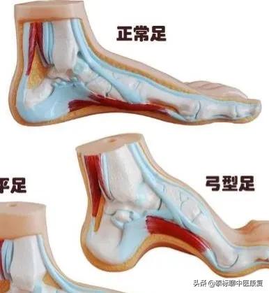 膝关节增生疼痛偏方,四神煎治膝关节疼痛