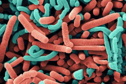 刘亦菲洗脸方法去闭口,刘亦菲推荐护肤水是什么