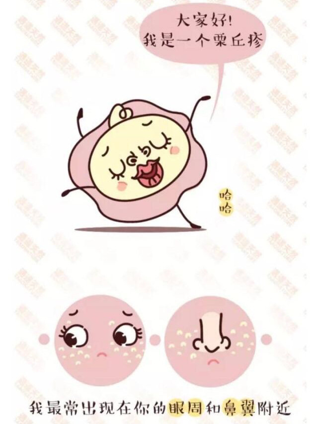 眼霜引起的脂肪粒怎么样能消除,眼霜导致的脂肪粒怎么消除