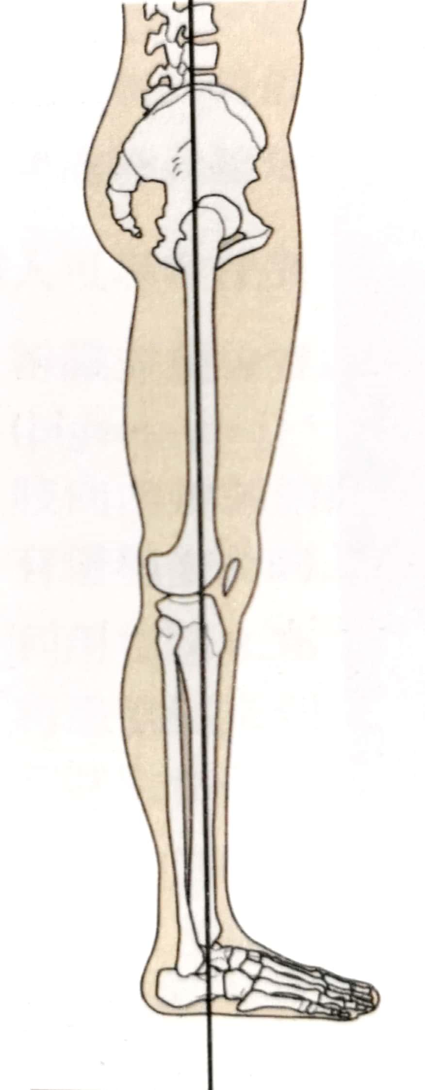 裤子历险记——腿太弯怎么办？