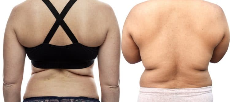 背部赘肉怎么减最快最有效的方法,怎样快速减背部的赘肉