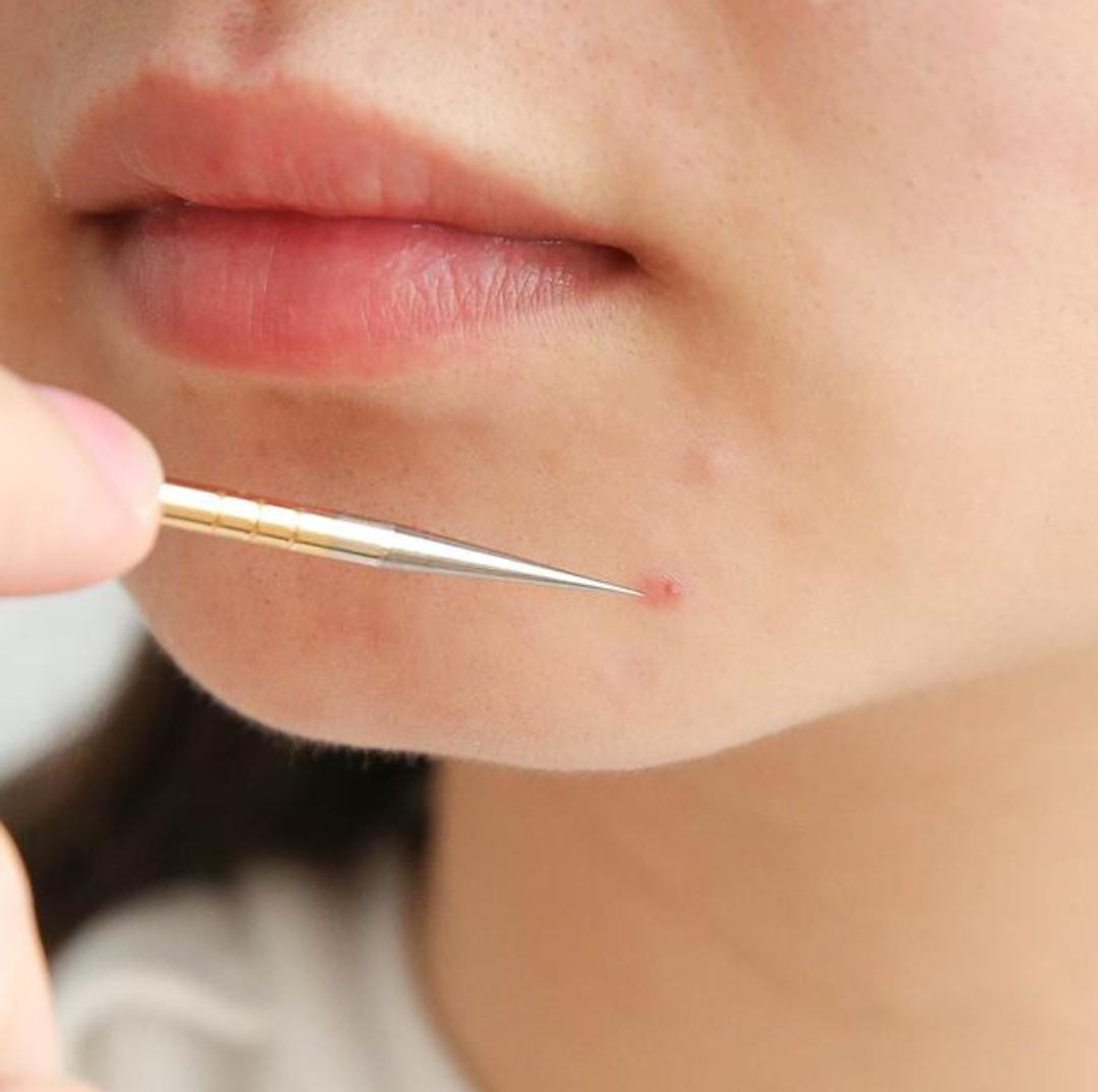 关于黑头的问题和解决方法,去黑头的误区许多人都中招了