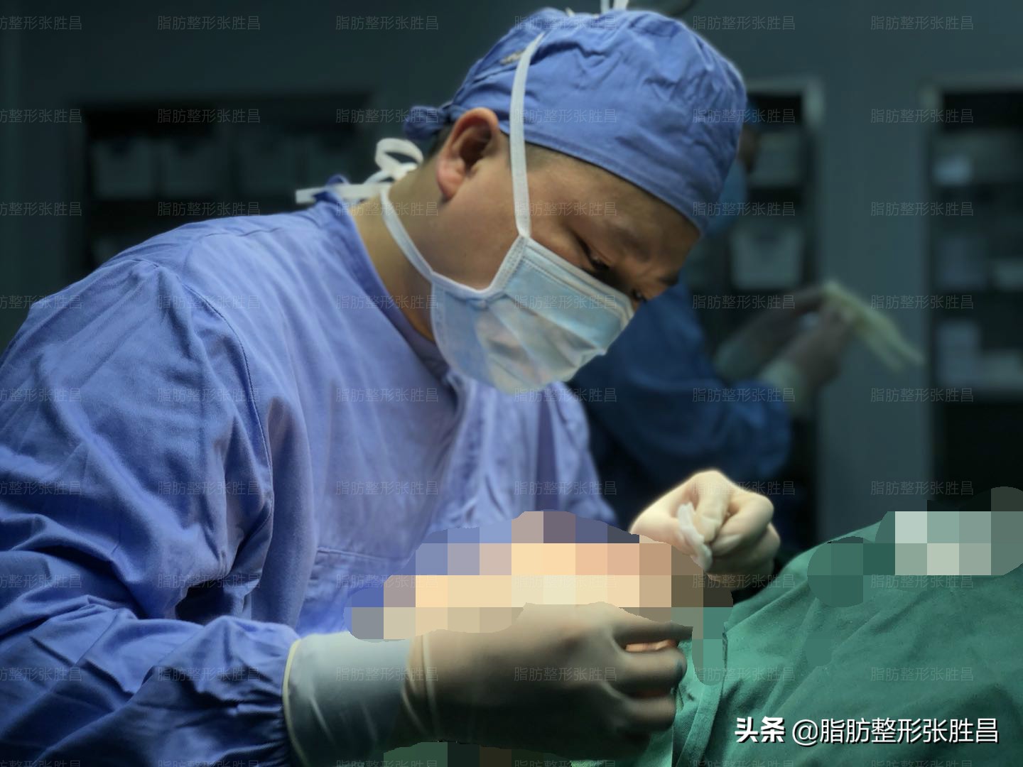 腰腹吸脂后如何穿塑身衣,腰腹吸脂后可以穿一般的塑身衣吗