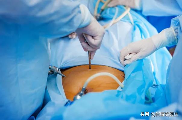 腹腔镜输卵管整形术全过程,腹腔镜做宫外孕开窗取胚术演示