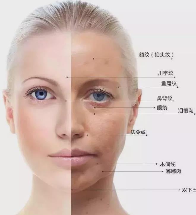 静态纹和动态纹哪个容易去掉,淡纹最快最有效的方法