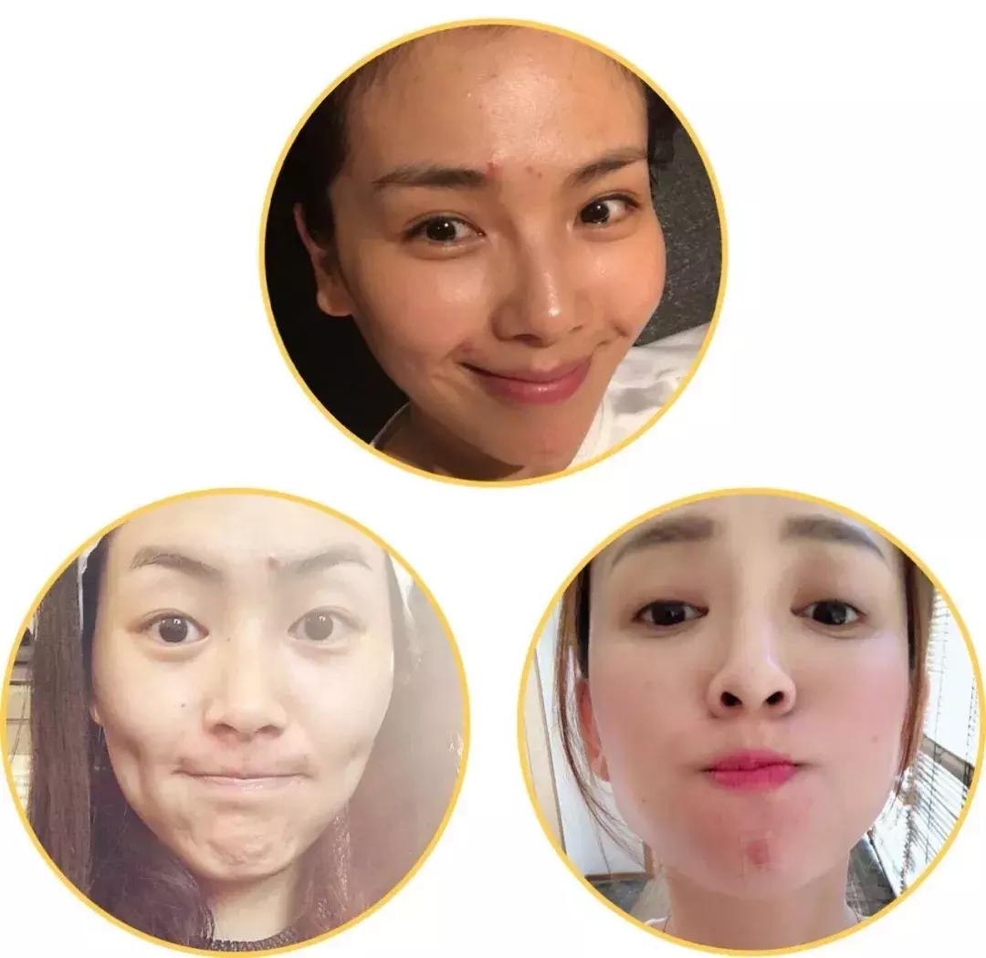 小时候的不好的习惯让自己变丑了,青春期有什么习惯可以防止变丑