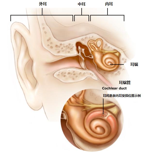 耳朵总有轰鸣声是怎么回事,耳朵嗡嗡响3招有效缓解